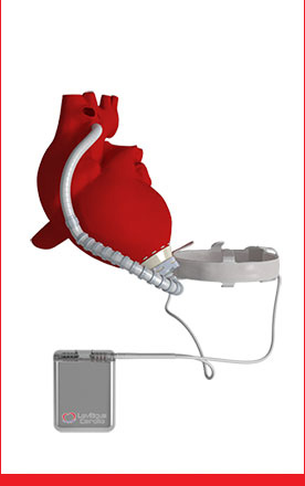 Leviticus Cardio